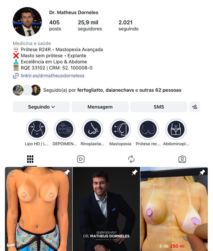 cirurgião plástico na barra da tijuca, cirurgião plástico barra da tijuca, cirurgião plástico rio de janeiro, cirurgião plástico rj, cirurgião plástico zona oeste rj, cirurgião plástico particular rj, cirurgia plástica barra da tijuca, clínica de cirurgia plástica barra da tijuca, cirurgia plástica rio de janeiro, melhor cirurgião plástico da barra, melhores cirurgiões plásticos do rio de janeiro, cirurgião plástico recomendado rj, cirurgião plástico bem avaliado barra da tijuca, cirurgia plástica de alto padrão rj, cirurgião plástico especializado em mamas, cirurgia das mamas rj, prótese de mama barra da tijuca, implante de silicone rj, aumento de mama rio de janeiro, mastopexia rj, mastopexia com prótese barra da tijuca, mastopexia sem prótese rj, lifting de mamas rj, explante de silicone rio de janeiro, retirada de prótese de mama rj, cirurgia de explante barra da tijuca, cirurgia mamária rj, cirurgião de mama rj, cirurgia de contorno corporal rj, lipoaspiração barra da tijuca, lipoaspiração rj, lipoescultura rio de janeiro, abdominoplastia rj, cirurgia abdominal estética rj, contorno corporal barra da tijuca, cirurgia plástica feminina rj, cirurgia plástica estética rj, cirurgia plástica particular barra da tijuca, cirurgião plástico de confiança rj, cirurgião plástico experiente rio de janeiro, dr matheus dorneles, dr matheus dorneles cirurgião plástico, clínica dr matheus dorneles, consultório de cirurgia plástica barra da tijuca, cirurgia plástica avenida das américas, cirurgião plástico avenida das américas, cirurgia plástica recreio dos bandeirantes, cirurgia plástica zona sul rj, cirurgia plástica leblon, cirurgia plástica barra premium.